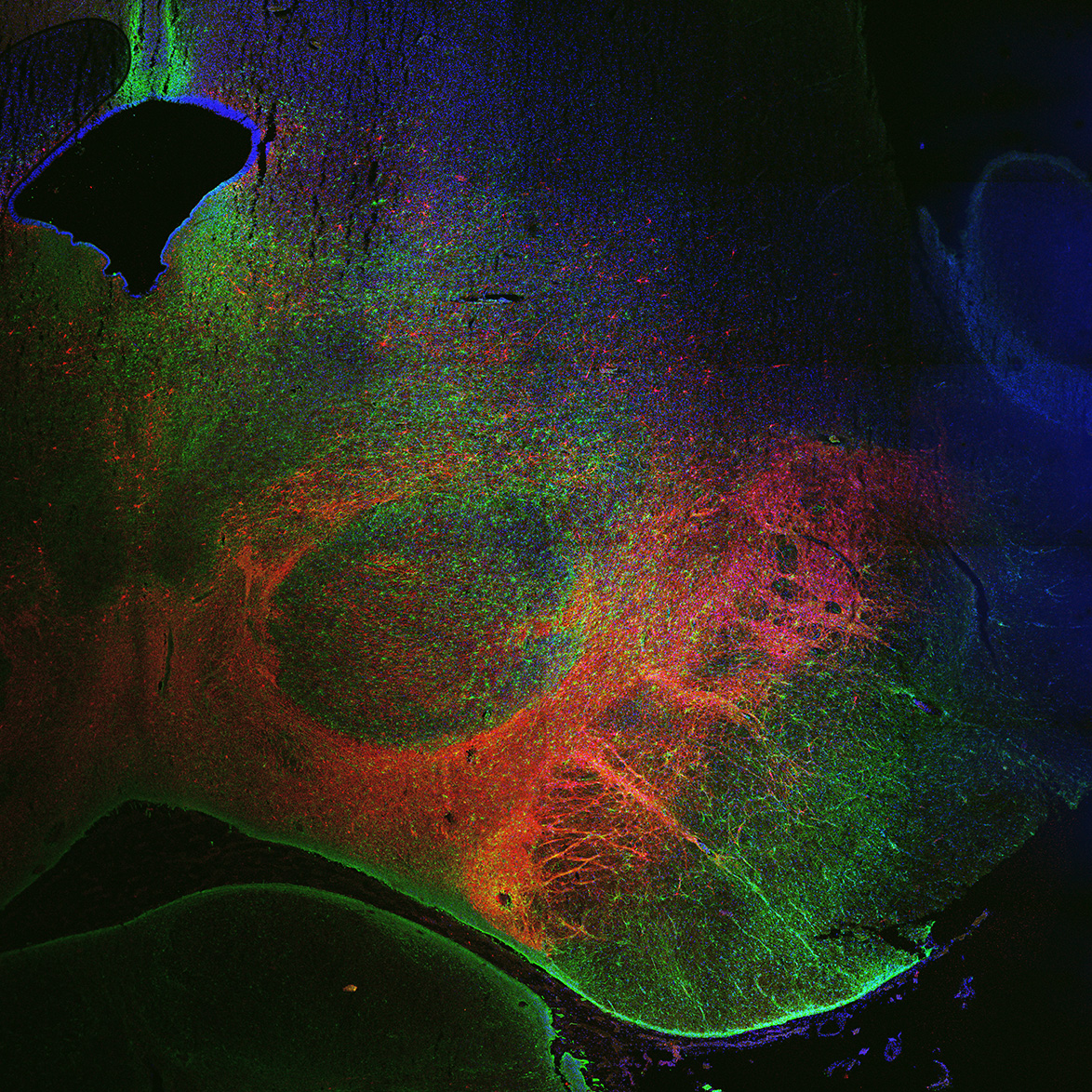 Human foetal midbrain